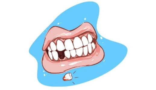 牙齿种类