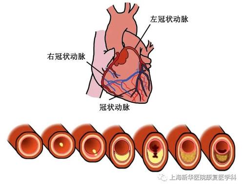 我和楼梯