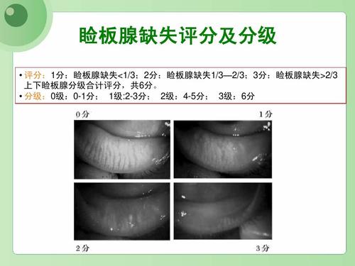 见眼科