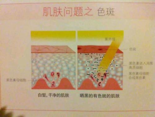 关于选择的重要性