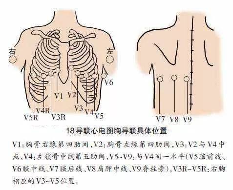 我终于明白了老师的意图。