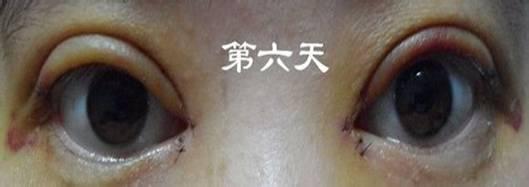 双重命运的眼睛第一卷_650字